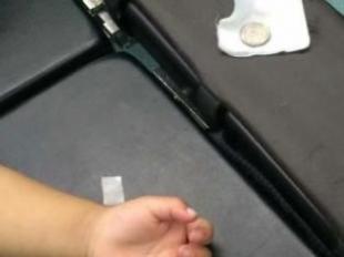 硬币卡喉命悬线、深夜医生转危安