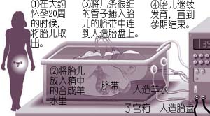 解决生育难题面临伦理困境 人造子宫有望成现实