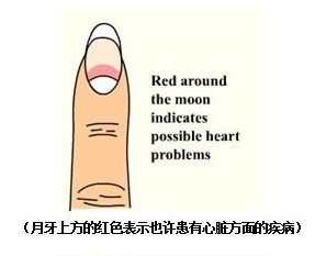 指甲出现十种状况要命！