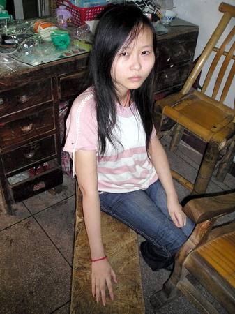 少女儿时摔倒后得怪病 周身无力脊椎畸形