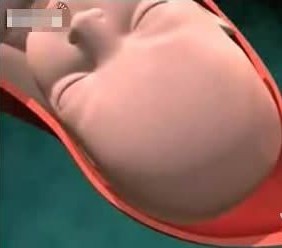 图解婴儿出生全过程