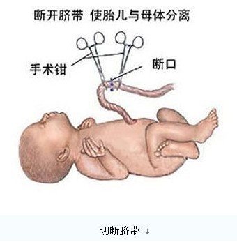 医学实录：女性剖腹产手术全过程