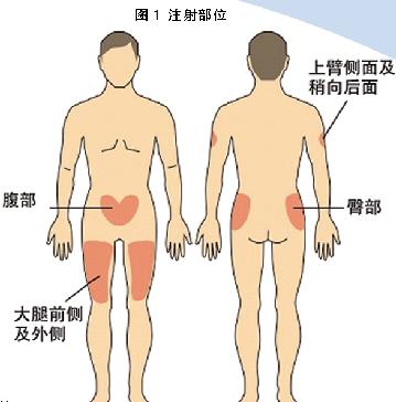 胰岛素皮下注射“三步曲”