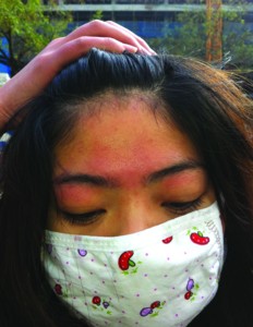女孩美容院被骗花千元护肤 面部浮肿吓走相亲男