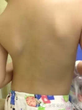 致第306医院马华松主任团队的一封感谢信
