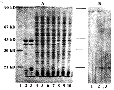 人淋巴毒素cDNA在大肠杆菌表达的研究①