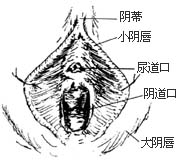 阴式全宫切除术