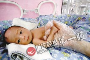 双胞胎新生儿双双患病 父亲一度欲放弃治疗