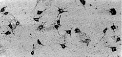 HBV基因组转染对小鼠NIH3T3细胞内基质金属蛋白酶组织抑制因子的转录调控作用
