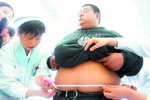 专家：未来十年我国的肥胖人群将超过2亿