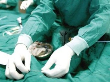 医疗器械市场存黑幕 心脏支架九倍暴利