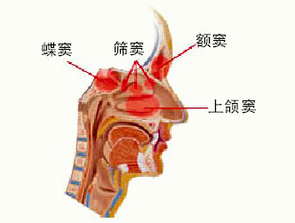 长期头痛 要看看耳鼻喉科