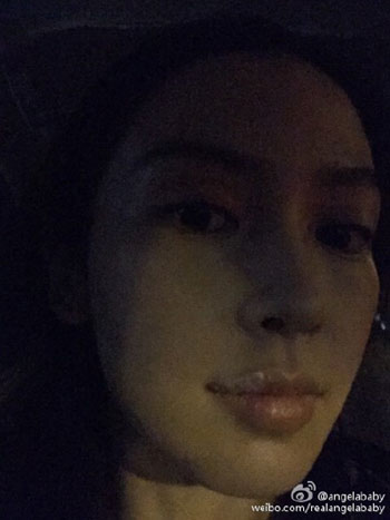 Angelababy嘴唇生疮 9个迹象表明身体有问题