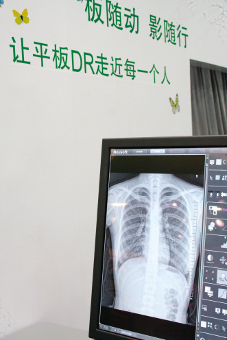 国产DR凭价格战小胜