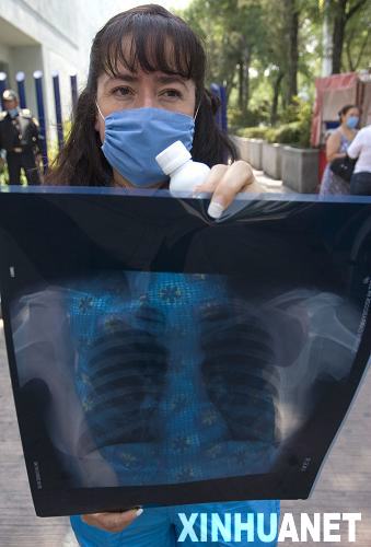 墨西哥确认和疑似死于猪流感人数升至103人