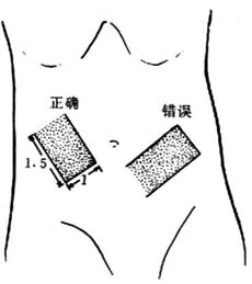 扁平皮瓣移植术