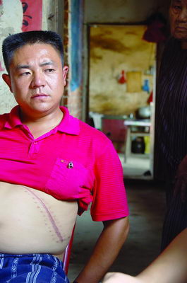 男子捐肾救朋友致生活陷入困境