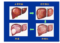 冬虫夏草抗肝纤维化有科学依据