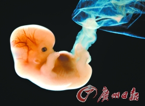 单独二孩政策促废弃胚胎解冻 或续费寄存