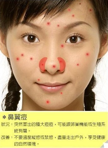 通过脸上痘痘位置看你的健康状况