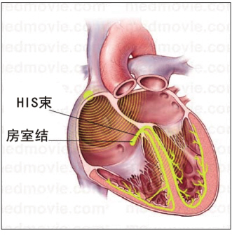 一线对策，控制室率