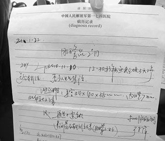 医生忘记患者是处女 B超仪器破处女膜
