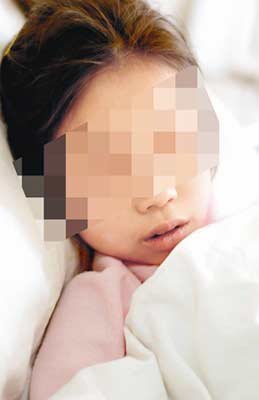 13岁女孩没有肛门粪便积在腹中两三年