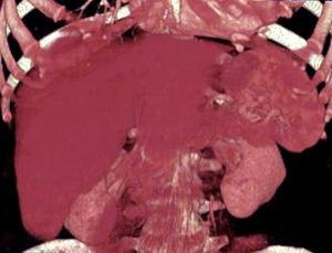 日本科学家成功在老鼠头部培育微型人类肝脏