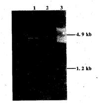 自身抗原La融合蛋白在大肠杆菌中的表达及免疫学鉴定