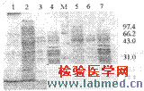 抗恶性疟HRP-Ⅱ单链抗体的制备和初步应用