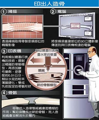加拿大学者仿喷墨打印技术精确制造人造骨