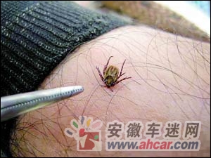 卫生部门分离出蜱虫所携新型病毒 人畜被蜱咬后最有效的应对措施