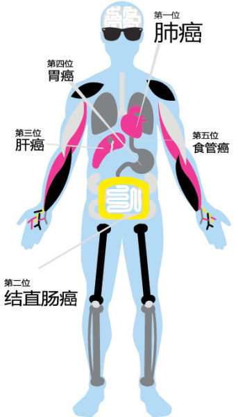 数据显示北京日增104名癌症患者 10年间增长4%