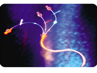 纳米医疗器械研发驶入快车道 成开发重点