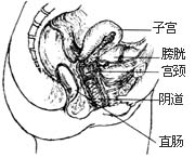 阴道前、后壁膨出（脱垂）修复术