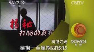 《科技之光·揭秘打嗝的真相》肺癌治疗新方法