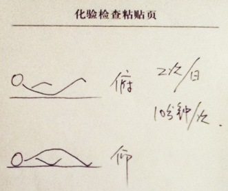 治疗腰肌劳损四字诀