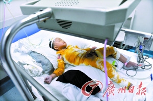 两岁女童掉进滚烫汤锅仍在抢救 警方介入调查