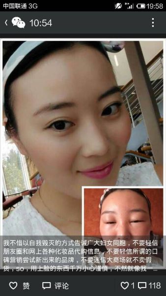 女白领用LV旗下面膜产品 脸肿成“猪头”