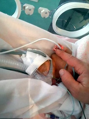 英国女婴早产16周 仍顽强生存