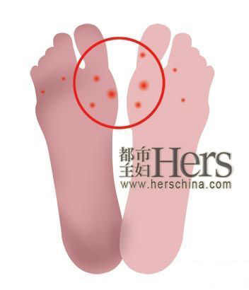第二大问题：痒，痒，还是痒