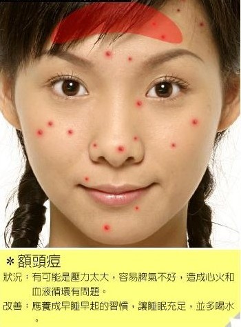 通过脸上痘痘位置看你的健康状况