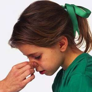 盘点十种坑爹保健常识：流鼻血时要抬高下巴