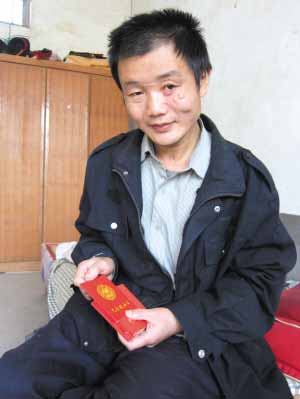 爱心男子3年献血16800ml 因容貌缺陷难就业