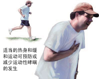 当心另类哮喘
