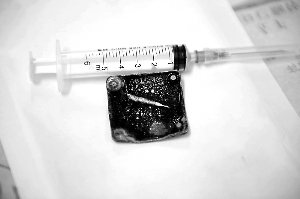 抑郁男子吞铁块轻生 异物卡食管难忍痛求救