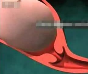 图解婴儿出生全过程