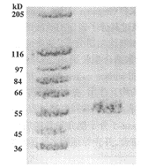 可溶性syndecan-1 对人多发性骨髓瘤细胞体外的生物学作用