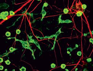 Neuron：小神经胶质细胞可保护机体免于退行性脑病