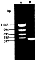 人钙调素基因表达载体的构建及在大肠杆菌DH5α中的表达①